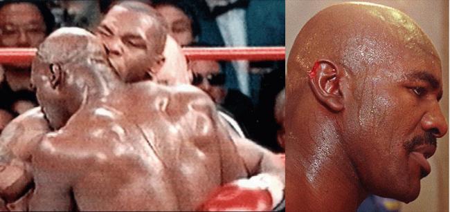 Quando Mike Tyson staccò con un morso l’orecchio di Holyfiled (VIDEO)