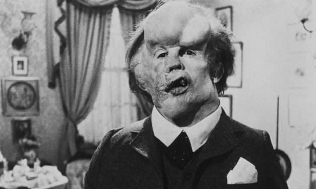 The Elephant Man, torna al cinema dopo 40 anni in versione restaurata