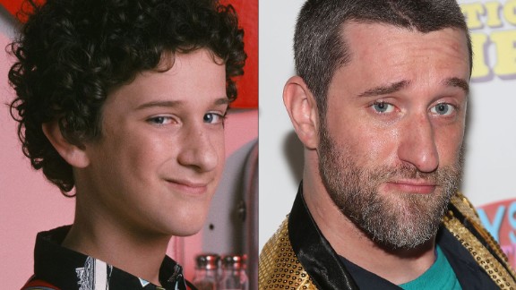 Dustin Diamond, Screech di Bayside School, ha un cancro al quarto stadio