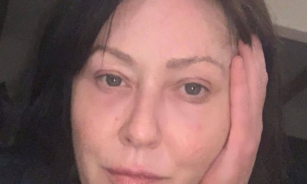 Shannen Doherty: “Sono sopravvissuta al cancro… il mio viso riflette la mia vita”