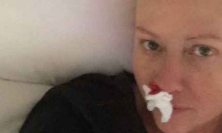 Shannen Doherty: “Ho avuto molti sanguinamenti dal naso a causa della chemio. L’umorismo mi ha salvato la vita”