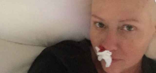 Shannen Doherty: “Ho avuto molti sanguinamenti dal naso a causa della chemio. L’umorismo mi ha salvato la vita”