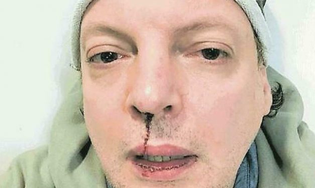 Il comico Dado rischia il processo: accusato di aver diffamato l’ex fidanzato della figlia