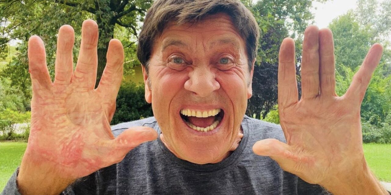 Gianni Morandi mostra la mano ustionata un anno e mezzo dopo l’incidente: “Voglia di urlare”