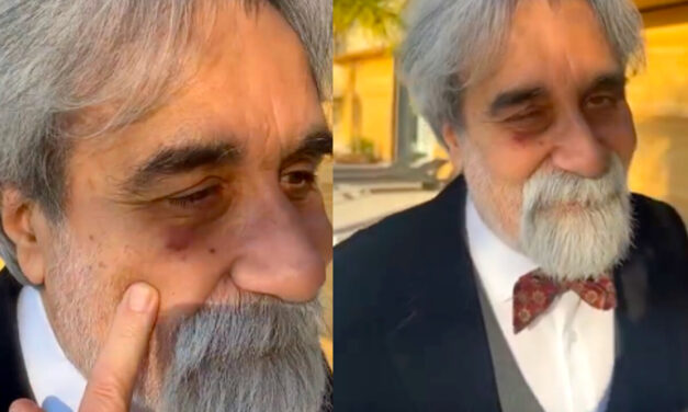 Beppe Vessicchio sbatte contro la vetrata della villa a Sanremo. Il livido all’occhio è virale