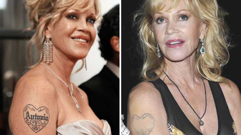 Melanie Griffith cancella il tatuaggio dedicato all’ex marito Antonio Banderas