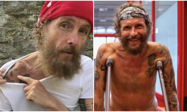 Jovanotti: “Non cammino ancora senza stampelle, dovrò rioperarmi per togliere la placca alla clavicola”