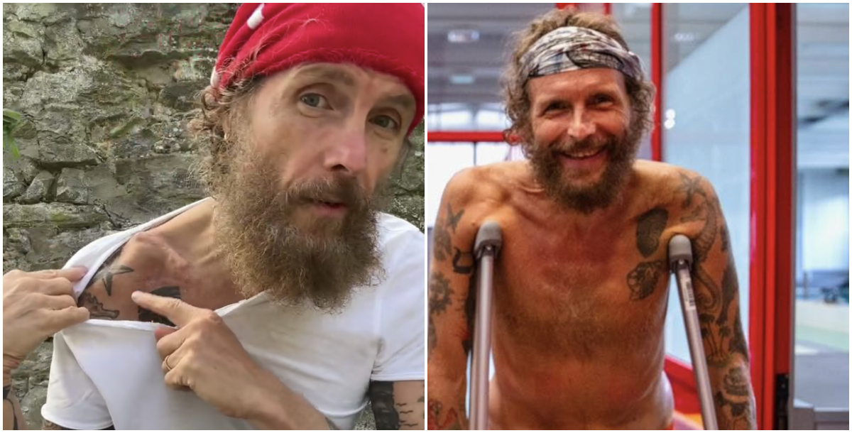 Jovanotti: “Non cammino ancora senza stampelle, dovrò rioperarmi per togliere la placca alla clavicola”