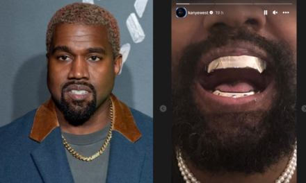 Kanye West si è fatto sostituire tutti i denti con una protesi al titanio da 850 mila dollari
