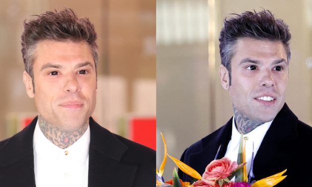 Sanremo 2025, Fedez sugli occhi nerissimi: “Ho messo le lenti”